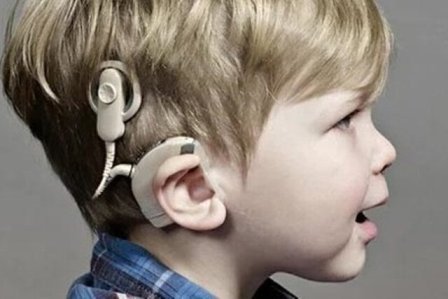پبش بینی انجام عمل سالانه ۳۴۰ کودک تحت کاشت حلزون شنوایی در گیلان